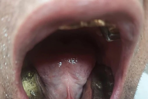 સોનાની દાણચોરીની આ અદબૂત પદ્ધતિ જોઈ અધિકારીઓ પણ થઈ ગયા આશ્ચર્યચકિત સોનાની દાણચોરીની આ અદબૂત પદ્ધતિ જોઈ અધિકારીઓ પણ થઈ ગયા આશ્ચર્યચકિત