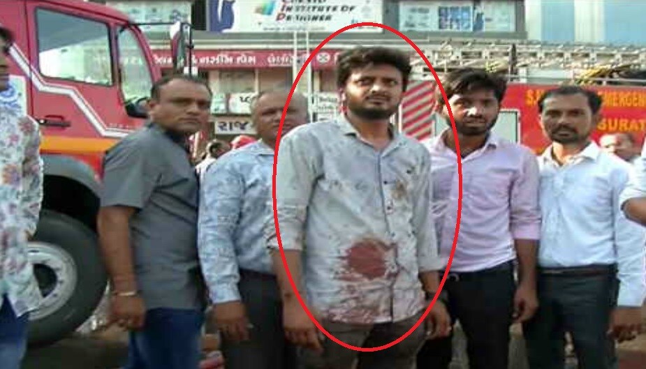 চুৰাটৰ তক্ষশিলা অট্টালিকাটোত যেতিয়া জুই লাগিছিল তেতিয়া তলত থিয় হৈ থকা লোকসকলে ওপৰলৈ ভয়ত ওপৰলৈ উঠি যোৱা নাছিল। কেতন জোৰবাডিয়া নামৰ এইজন যুৱকে জুইৰ মাজত আবদ্ধ হৈ থকা লোকক উদ্ধাৰ কৰিবলৈ নিজৰ জীৱনকো উচৰ্গা কৰি দিয়ে। চুৰাটৰ তক্ষশিলা অট্টালিকাটোত যেতিয়া জুই লাগিছিল তেতিয়া তলত থিয় হৈ থকা লোকসকলে ওপৰলৈ ভয়ত ওপৰলৈ উঠি যোৱা নাছিল। কেতন জোৰবাডিয়া নামৰ এইজন যুৱকে জুইৰ মাজত আবদ্ধ হৈ থকা লোকক উদ্ধাৰ কৰিবলৈ নিজৰ জীৱনকো উচৰ্গা কৰি দিয়ে।