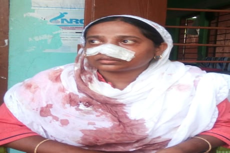 নকল ধৰাৰ বাবে ৰাইজে ঘুচিয়াই ভাঙিলে টেট শিক্ষয়িত্ৰীৰ নাক নকল ধৰাৰ বাবে ৰাইজে ঘুচিয়াই ভাঙিলে টেট শিক্ষয়িত্ৰীৰ নাক