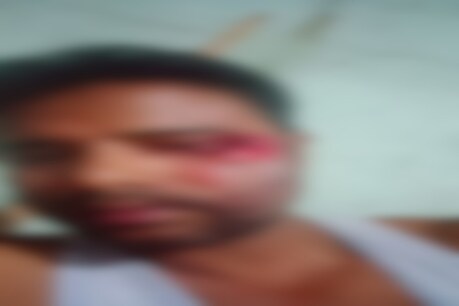 মাজুলীত দুৰ্বৃত্তই আক্ৰমণ কৰিলে সাংবাদিকক মাজুলীত দুৰ্বৃত্তই আক্ৰমণ কৰিলে সাংবাদিকক