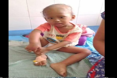 পখিলা খেদাৰ বসয়তে কণমানি বৰ্ণিলৰ দেহত ধৰা পৰিছে দুৰাৰোগ্য ৰোগ, এতিয়া প্ৰয়োজন হৈছে আপোনাৰ কিছু সহায় পখিলা খেদাৰ বসয়তে কণমানি বৰ্ণিলৰ দেহত ধৰা পৰিছে দুৰাৰোগ্য ৰোগ, এতিয়া প্ৰয়োজন হৈছে আপোনাৰ কিছু সহায়