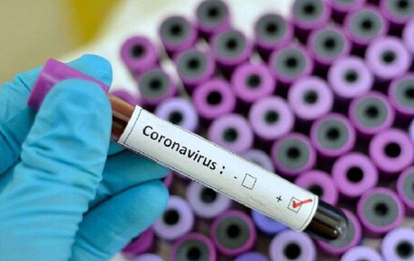 Covid–19: অসমত নতুনকৈ ৮জনৰ দেহত ক’ৰোণাৰ অৱস্থিতি, আক্ৰান্তৰ সংখ্যা ১৩ জনলৈ বৃদ্ধি Covid–19: অসমত নতুনকৈ ৮জনৰ দেহত ক’ৰোণাৰ অৱস্থিতি, আক্ৰান্তৰ সংখ্যা ১৩ জনলৈ বৃদ্ধি