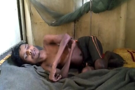 দেখিলেই ওলাব চকুপানী, ১৫ বছৰে এনেদৰেই কটাইছে পিতৃ-মাতৃহীন এইগৰাকী যুৱকে দেখিলেই ওলাব চকুপানী, ১৫ বছৰে এনেদৰেই কটাইছে পিতৃ-মাতৃহীন এইগৰাকী যুৱকে