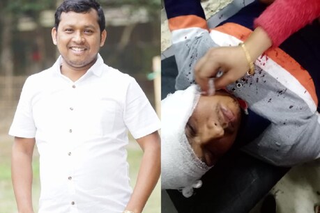 যুৱতীৰ জীৱন ৰক্ষা কৰিবলৈ গৈ দাৰ ঘাপ খালে সাংবাদিক আফনুৰ আলীয়ে, জি এম চি এইচত চিকিৎসাধীন যুৱতীৰ জীৱন ৰক্ষা কৰিবলৈ গৈ দাৰ ঘাপ খালে সাংবাদিক আফনুৰ আলীয়ে, জি এম চি এইচত চিকিৎসাধীন