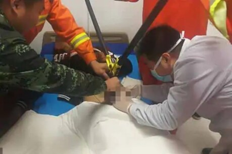 ভেলেন্টাইন ডে'ত প্ৰেমিকাক আকৰ্ষণ কৰিবলৈ এয়া কি কৰিলে ? যৌনাংগত লাগি ধৰিলে আঙুঠি, যাবলগীয়া হ'ল চিকিৎসালয়লৈ ভেলেন্টাইন ডে'ত প্ৰেমিকাক আকৰ্ষণ কৰিবলৈ এয়া কি কৰিলে ? যৌনাংগত লাগি ধৰিলে আঙুঠি, যাবলগীয়া হ'ল চিকিৎসালয়লৈ