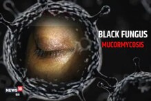 সাৱধান! সমগ্ৰ দেশৰ ৭২৫১জন লোক আক্ৰান্ত হ'ল Black Fungusত; প্ৰাণ ল’লে ২১৯জনৰ 