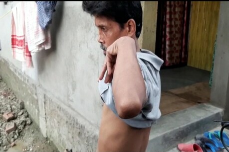 Breaking News: ধৰমতুলৰ পাছত এইবাৰ নগাঁৱৰ হুজ গাঁৱত সক্ৰিয় কিডনীৰ ব্যৱসায় চক্ৰ, সম্প্ৰতি কিডনী বিক্ৰীৰ বাবে কলকাতাত কেইবাজনো ব্যক্তি... Breaking News: ধৰমতুলৰ পাছত এইবাৰ নগাঁৱৰ হুজ গাঁৱত সক্ৰিয় কিডনীৰ ব্যৱসায় চক্ৰ, সম্প্ৰতি কিডনী বিক্ৰীৰ বাবে কলকাতাত কেইবাজনো ব্যক্তি...