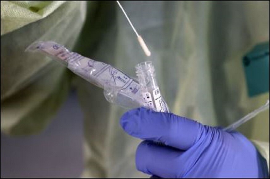  নতুন কোভিড টেষ্ট (Covid Test) প্ৰস্তুত কৰা বাৰ্মিংহাম বিশ্ববিদ্যালয়ৰ গৱেষকসকলে দাবী কৰে যে ই আৰটি-পিচিআৰ পৰীক্ষাতকৈ দ্ৰুত আৰু সঠিক ফলাফল দিয়ে। নতুন পৰীক্ষাটোৰ নাম RTF-EXPAR ৰখা হৈছে, গৱেষকসকলে কয়।