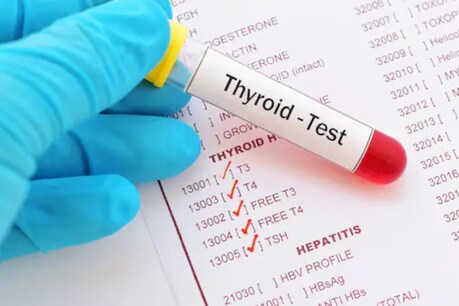 Thyroid Symptoms: যদি আপোনাৰ এইসমূহ সমস্যা দেখিছে, সোনকালেই Thyroid Test কৰাওক ! পৰীক্ষাৰ পূৰ্বে জানি লওক থাইৰইড গ্ৰন্থি কি, ইয়াৰ কাৰ্য কি, ইয়াৰ পৰা কি কি সমস্যা হয় ?