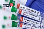 দিল্লীত Monkeypoxৰ পঞ্চমগৰাকী ৰোগী, LNJP চিকিৎসালয়ত ভৰ্তি মহিলা সংক্ৰমিত !