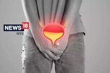প্ৰস্ৰাৱৰ জ্বলা-পোৰা আৰু UTI হালধীয়া হোৱাৰ ৫ টা গুৰুতৰ লক্ষণক অৱজ্ঞা নকৰিব