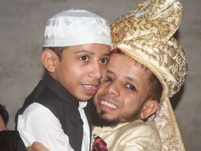 Shamli news, hapur news, azeem mansuri wedding, dwarf azeem mansuri wedding photo 30 inch height azeem mansuri wedding photos, azeem mansuri wedding with 3 feet long bushra