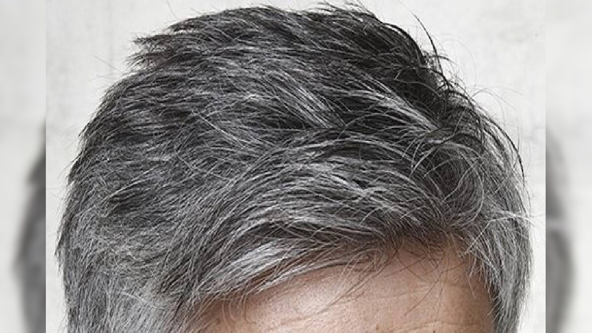 Grey Hair Problem: অকালতে চুলি পকিছে নেকি? কিন্তু কিয় এনে হৈছে, ইয়াৰ ...
