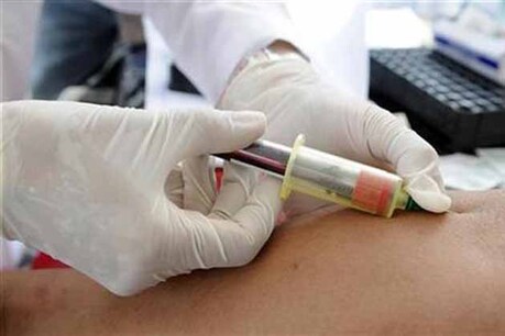 एड्स से बचने के लिए USA में सबका HIV टेस्ट होगा जरूरी! एड्स से बचने के लिए USA में सबका HIV टेस्ट होगा जरूरी!
