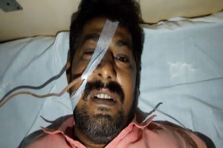 पुलिस हिरासत में दी गई थर्ड डिग्री से बुरी तरह घायल बालिस्टर सिंह