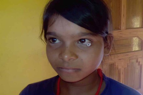 छात्रा की आंख से निकल रहे रूई और धागे, चिकित्सक भी हैरान छात्रा की आंख से निकल रहे रूई और धागे, चिकित्सक भी हैरान