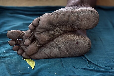 प्रतीकात्मक तस्वीर
(getty image)