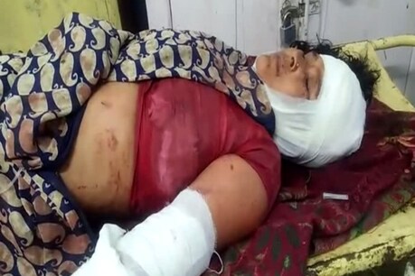 हथौड़े के हमले से घायल महिला.