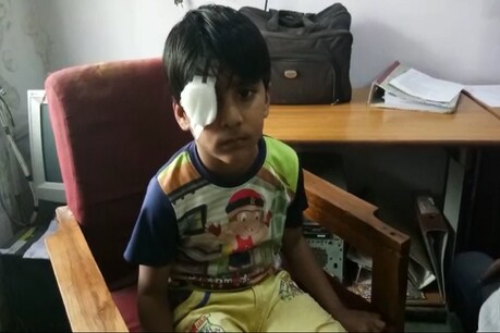 बच्चे ने परिजनों को बताया कि क्लास टीचर ने स्केल से मारा था, जिसकी वजह से आंख में चोट आई.