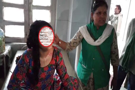 अस्पताल में तेजाब से झुलसी रेप पीड़िता