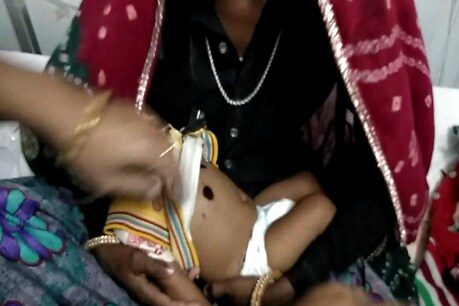 मासूम को ढोंगी बाबा ने एसिड से जलाया, मुश्किल से बची जान मासूम को ढोंगी बाबा ने एसिड से जलाया, मुश्किल से बची जान