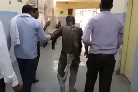 गंभीर रूप से जले युवक को स्ट्रेचर तक न दे सका अस्पताल. Photo: News 18