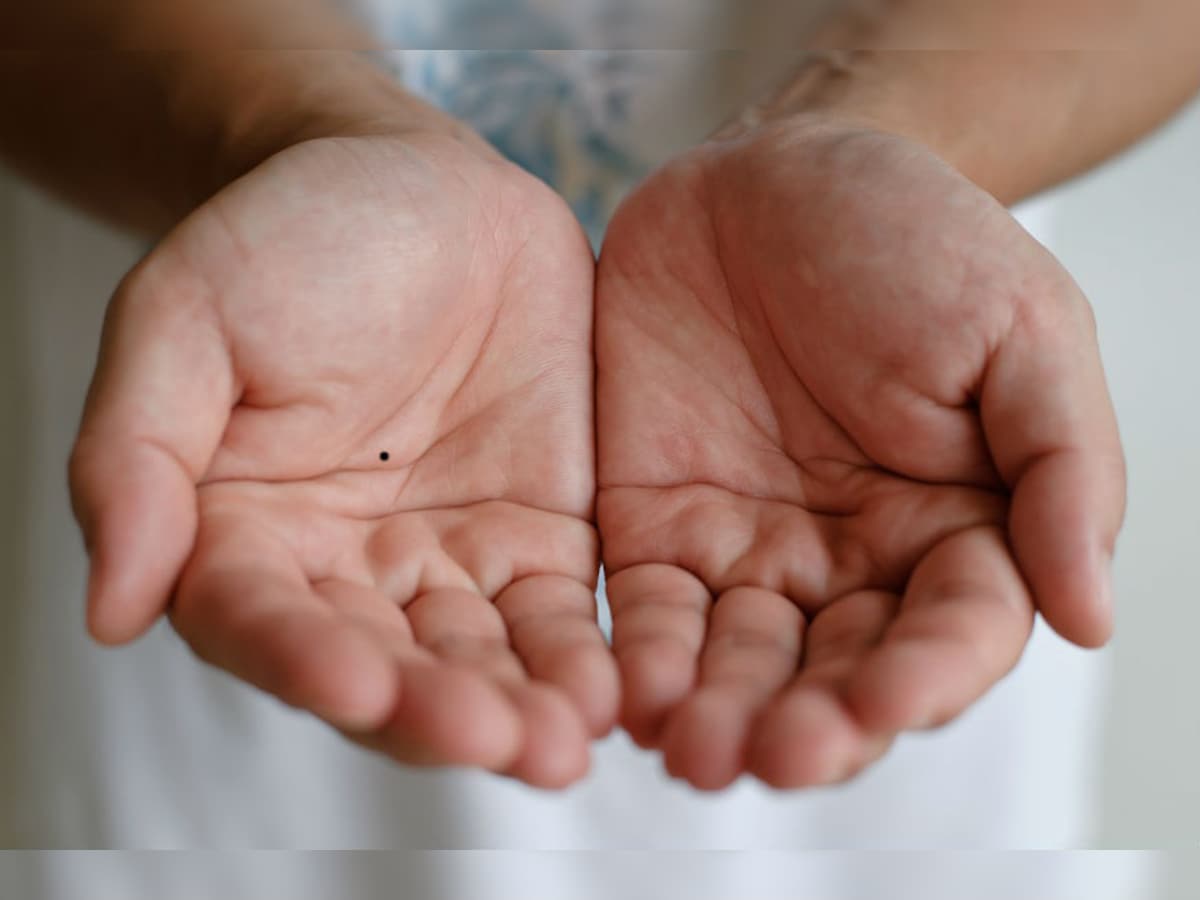Moles on Hand