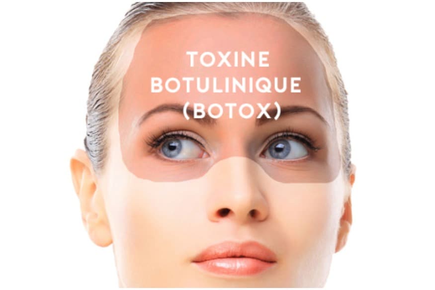 An Approach to Botox Unlike Any Other