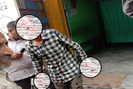 तेंदुए के हमले में घायल हुआ व्यक्ति