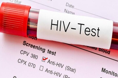 शिमला के प्राइवेट अस्पताल ने महिला HIV पॉजिटिव बता दिया. इससे सदमे में आइ महिला की मौत हो गई.