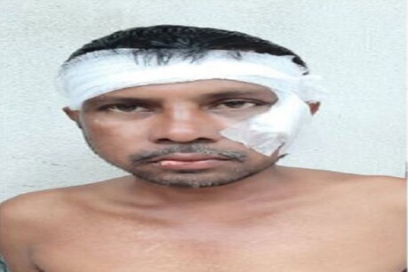 घायल रंजीत मंडल.