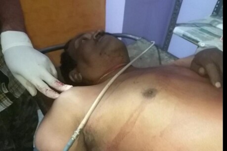 सासाराम में अपराधियों की गोली से जख्मी व्यवसायी