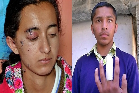 स्कूल की कैमिस्ट्री लैब में ब्लास्ट: घायल बच्चों ने बताई घटना की पूरी कहानी स्कूल की कैमिस्ट्री लैब में ब्लास्ट: घायल बच्चों ने बताई घटना की पूरी कहानी