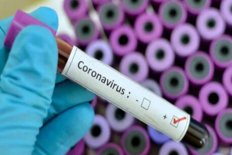 CoronaVirus: वैज्ञानिकों का दावा, इतने वक्त में आ जाएगा बाजार में कोरोना का टीका CoronaVirus: वैज्ञानिकों का दावा, इतने वक्त में आ जाएगा बाजार में कोरोना का टीका