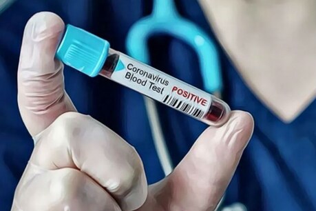 दुबई से लौटे तीन लोगों को माना गया कोरोना का संदिग्ध, जांच के लिए भेजा ब्लड सैम्पल दुबई से लौटे तीन लोगों को माना गया कोरोना का संदिग्ध, जांच के लिए भेजा ब्लड सैम्पल