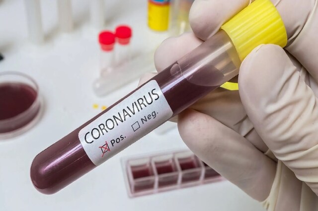 Coronavirus से खुद जिंदगी की जंग हार गया यह दिग्‍गज खिलाड़ी