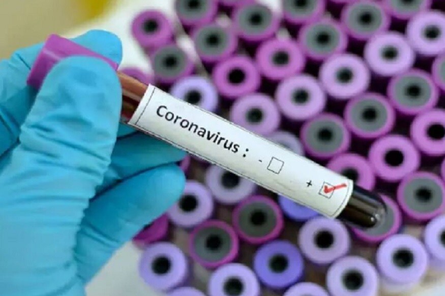 coronavirus in india, coronavirus update in india, coronavirus vaccine ,italy, coronavirus pune, covid-19, coronavirus mumbai, coronavirus update india, italy coronavirus, coronavirus worldometer, coronavirus italy, coronavirus count, कोरोना, कोरोना वायरस, जबलपुर न्यूज, कोविड 19, मध्य प्रदेश न्यूज, Corona, Corona Virus, jabalpur news, covid 19, madhya pradesh news, prisoner, face mask