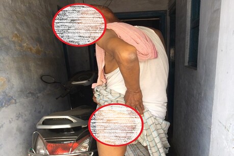 बेगूसराय में अधिकारियों ने अपने बॉडगार्ड्स से आरटीआई कार्यकर्ता को पिटवाया