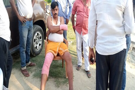 छपरा: लॉकडाउन तोड़ रहे दो बाइक सवार युवकों ने पुलिसकर्मी को मारी टक्कर, तीनों घायल छपरा: लॉकडाउन तोड़ रहे दो बाइक सवार युवकों ने पुलिसकर्मी को मारी टक्कर, तीनों घायल
