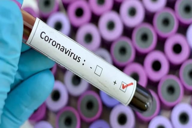 COVID-19 नूंह जिले में कोरोना पॉजिटिव केसों की संख्या 8 से बढ़कर हुई 14 COVID-19 नूंह जिले में कोरोना पॉजिटिव केसों की संख्या 8 से बढ़कर हुई 14