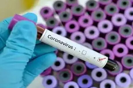 Agra COVID-19 Update: 104 पहुंची कोरोना पॉजिटिव मरीजों की संख्या, SN मेडिकल कॉलेज में जांच शुरू Agra COVID-19 Update: 104 पहुंची कोरोना पॉजिटिव मरीजों की संख्या, SN मेडिकल कॉलेज में जांच शुरू