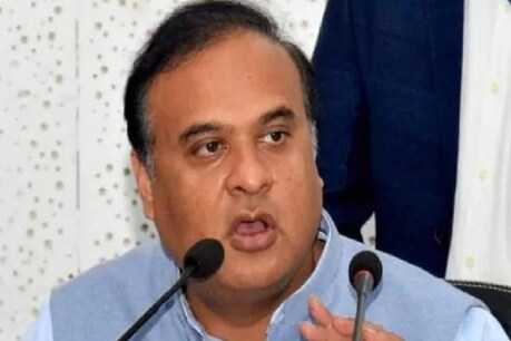 असम के स्वास्थ्य मंत्री को गुर्दे में पथरी, सोनोवाल ने कहा- आपकी अच्छी सेहत बहुत कीमती असम के स्वास्थ्य मंत्री को गुर्दे में पथरी, सोनोवाल ने कहा- आपकी अच्छी सेहत बहुत कीमती