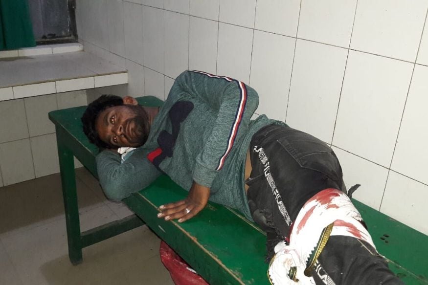 घायल इनामी बदमाश