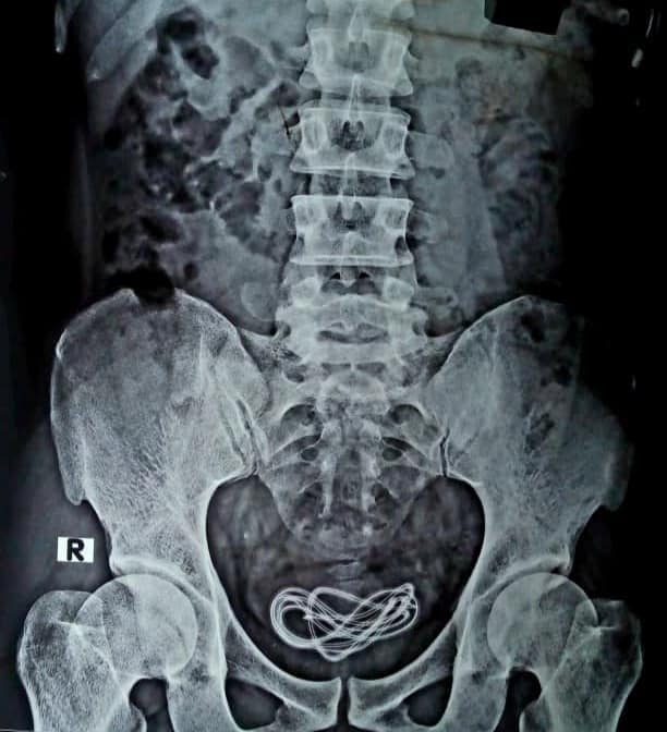 Assam, Masterbet, Mobile Charger, Surgery, Doctor