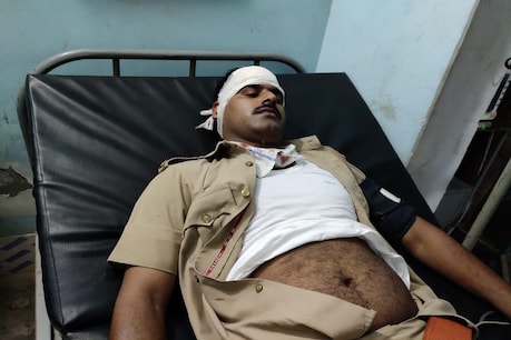 प्रतापगढ़ में पुलिस टीम पर दबंगों ने किया हमला, 2 सिपाही घायल, एक की हालत गंभीर