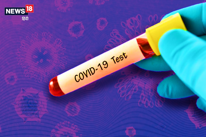 Coronavirus infection,