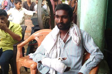 कानपुर पुलिस का कारनामा: किडनैपर्स को पकड़ने की जगह अगवा युवक के भाई को जमकर पीटा, टूटा हाथ कानपुर पुलिस का कारनामा: किडनैपर्स को पकड़ने की जगह अगवा युवक के भाई को जमकर पीटा, टूटा हाथ