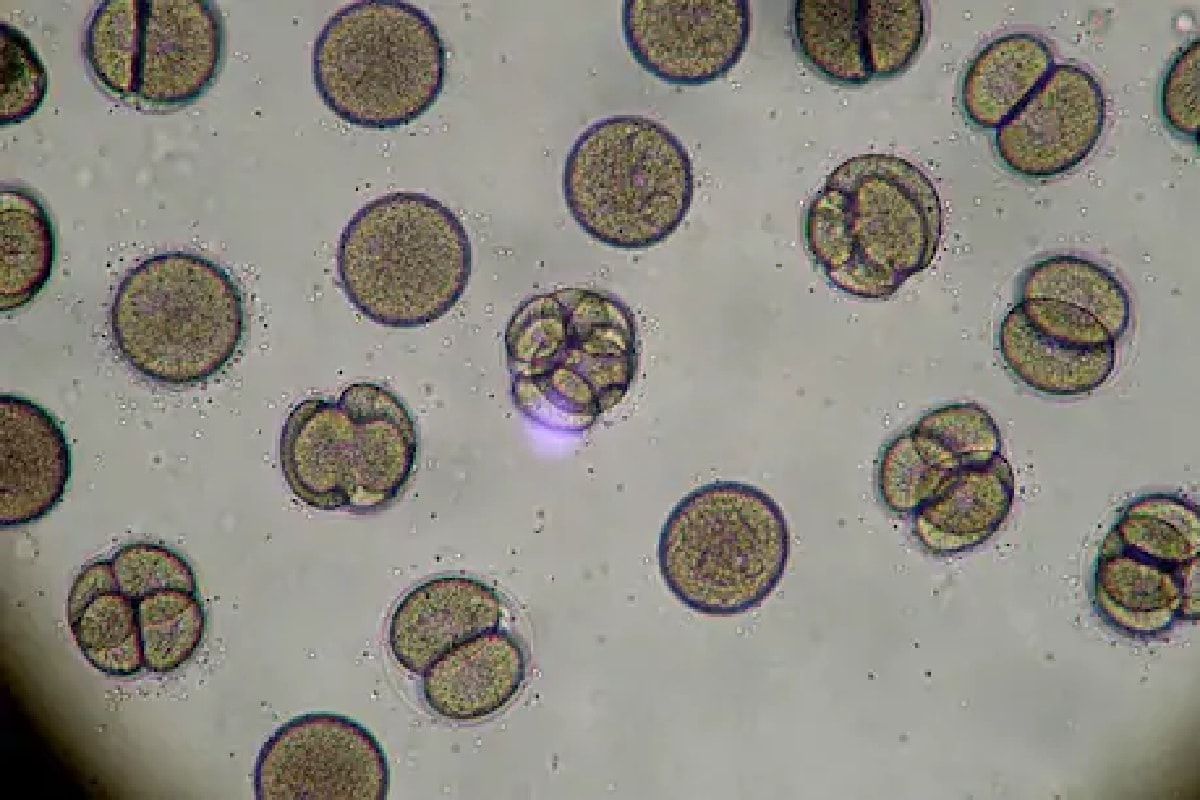 Bacteria