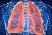 क्या होता है Lung Cancer, क्या रहती है इसके ठीक होने की स्थिति