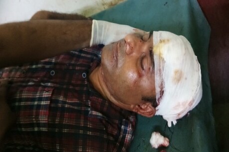 मुजफ्फरपुर: भीड़ ने पुलिस टीम पर हमला कर पिस्टल छीनी, थानेदार गंभीर हालत में आईसीयू में भर्ती